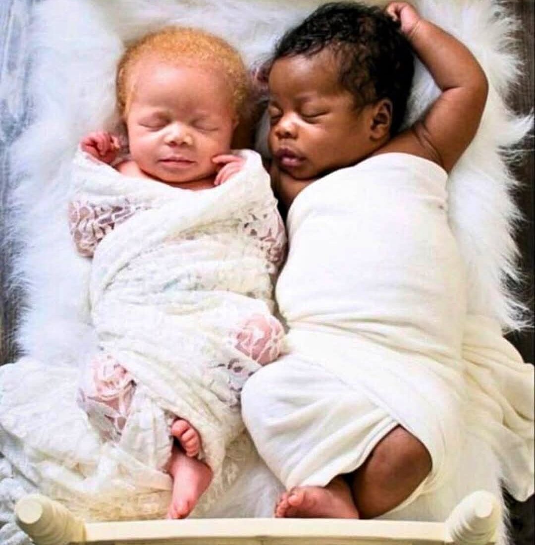 Rare Miracle: Mother Gives Birth to Black and White Twin Boys!