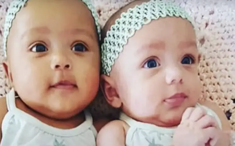 A Young Woman in the UK Gave Birth to Remarkably Different Twins — Then the Same Thing Happened Again 7 Years Later