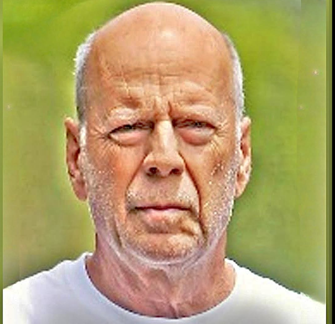 Bruce Willis’s Condition Has His Daughters Worried About Their Own Health